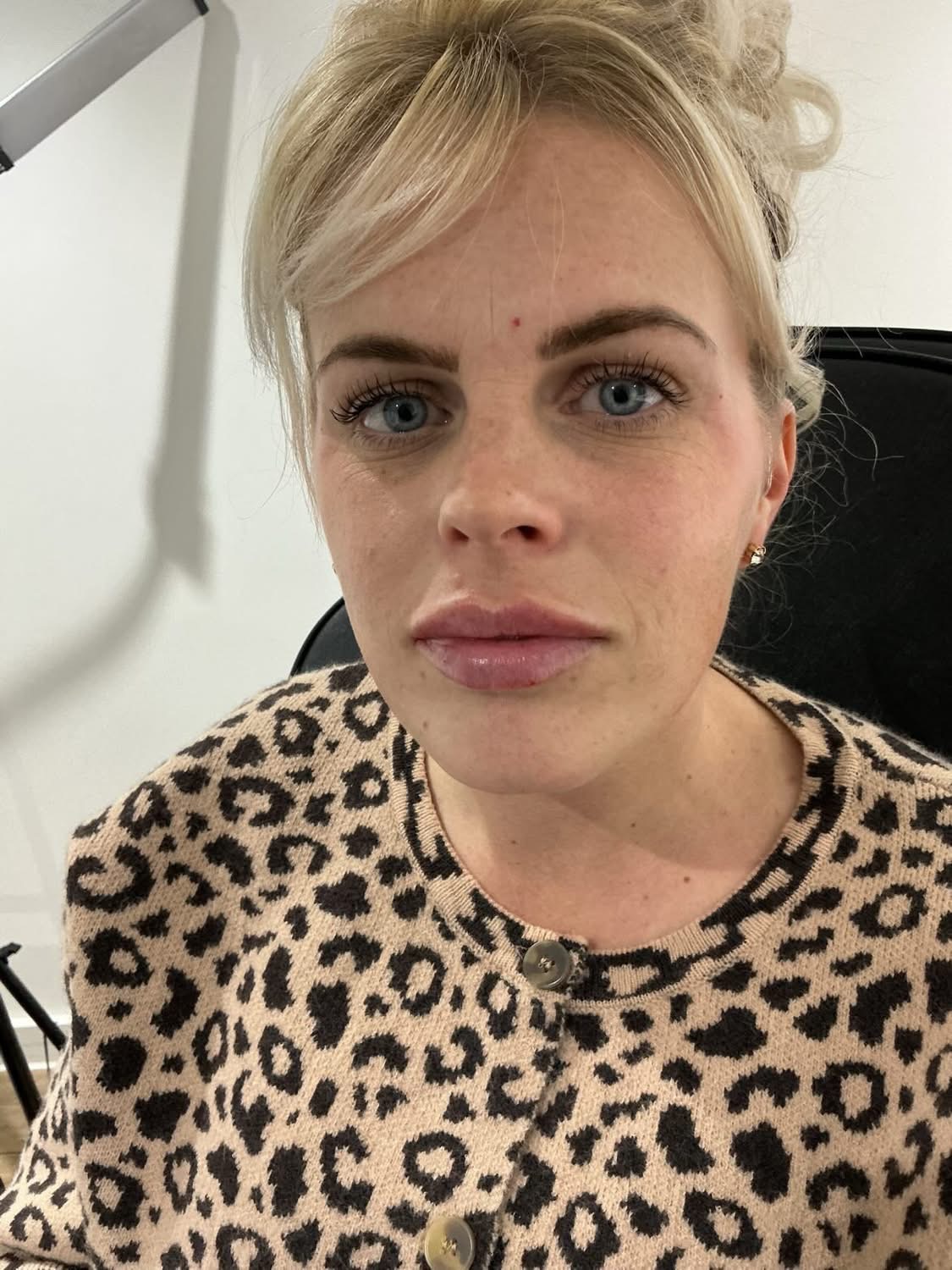 Client close-up after treatment