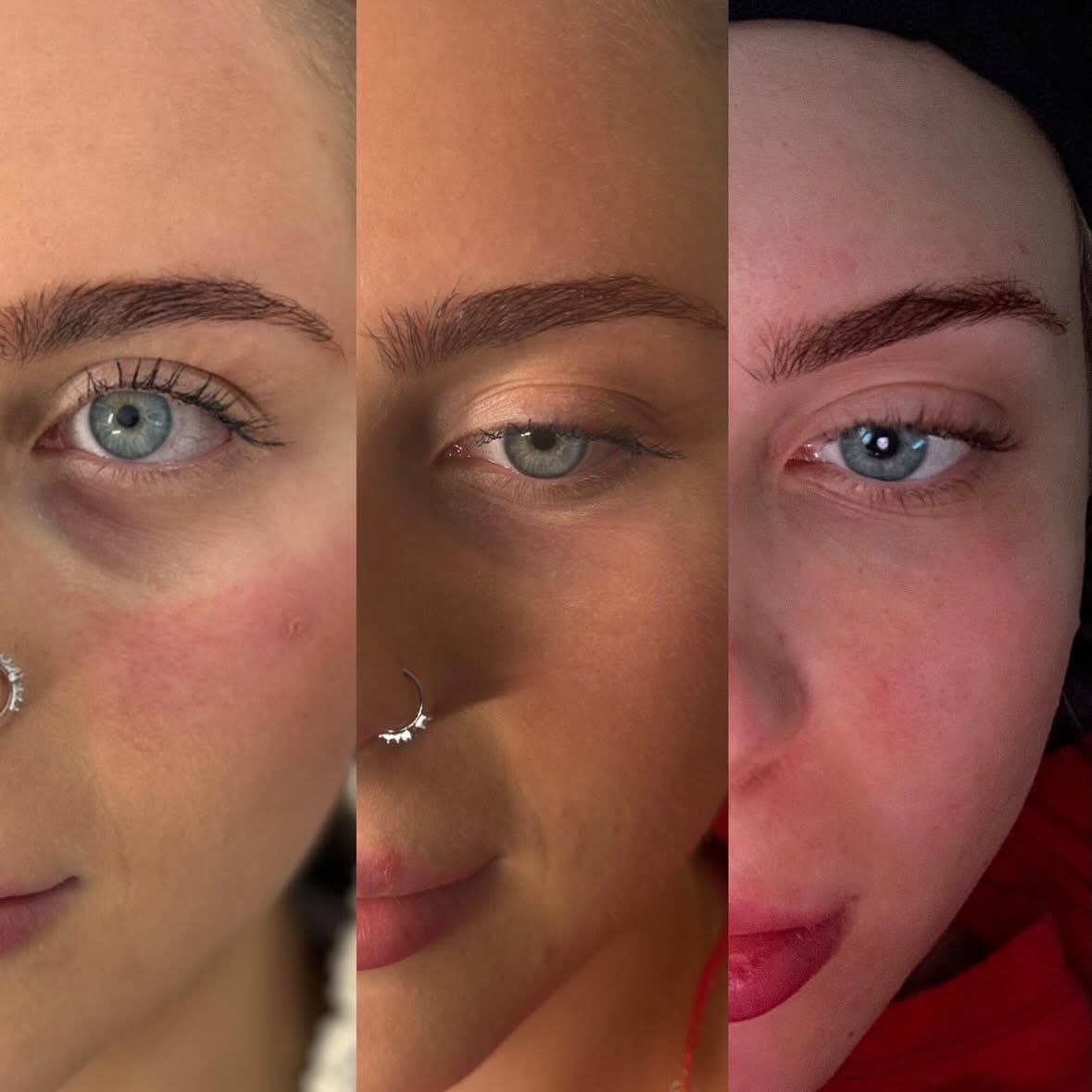 Three-stage skin improvement collage